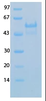 SARS-CoV-2 (COVID-19) Envelope Recombinant Protein