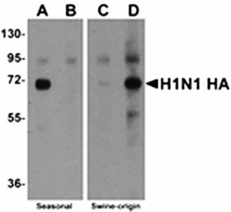 Seasonal H1N1 Hemagglutinin Antibody