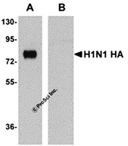 Seasonal H1N1 Hemagglutinin Monoclonal Antibody