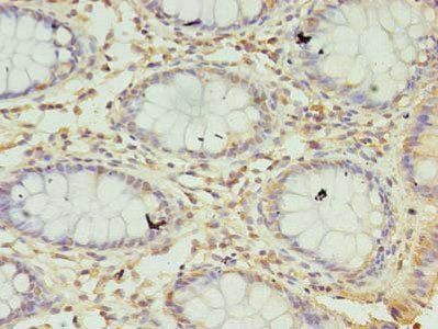 SEC11A Antibody