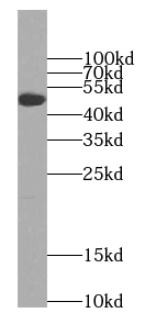 SEC61alpha antibody