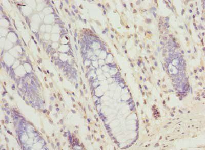 SEC61G Antibody