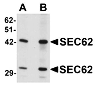 SEC62 Antibody