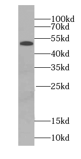 Secretogranin III antibody