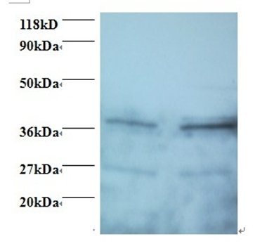 Secretory carrier-associated protein 3 antibody (Biotin)