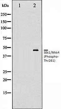 SEk1/Mkk4 (Phospho-Thr261) antibody