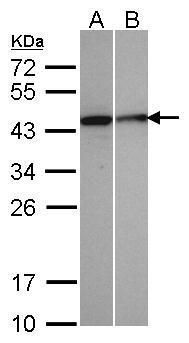 Selenophosphate synthetase 1 Rabbit Polyclonal Antibody