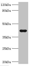 Selenoprotein P antibody