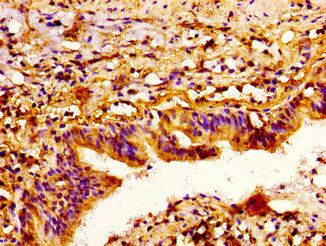 SEMA3A Antibody
