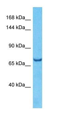 SEMA3B antibody