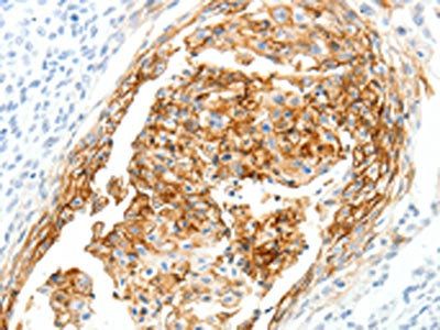 SEMA3D Antibody