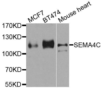 SEMA4C antibody