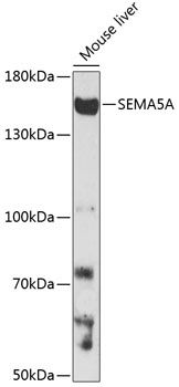 SEMA5A antibody