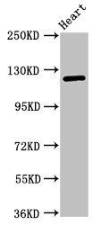 SEMA5B antibody