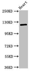 SEMA5B Antibody