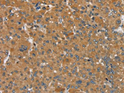 SEMA6D Antibody