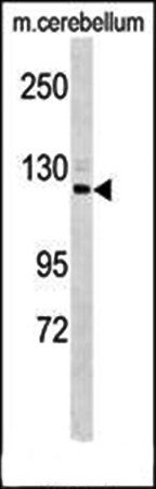 SEMA6D antibody