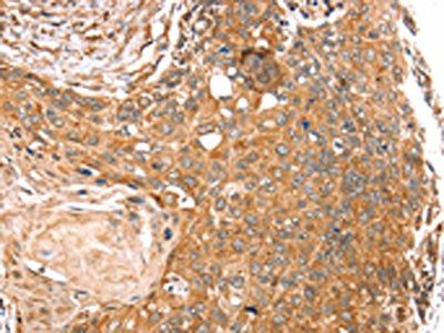 SEMA7A Antibody