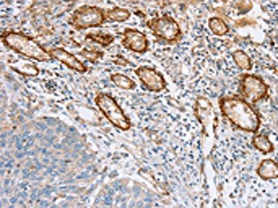 SEMA7A Antibody