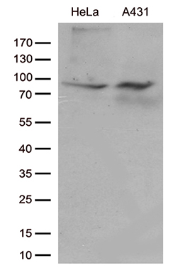 Semaphorin 4D (SEMA4D) antibody