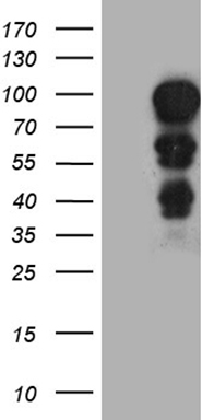 Semaphorin 4D (SEMA4D) antibody
