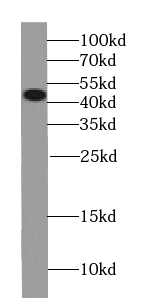 Semenogelin-1 antibody