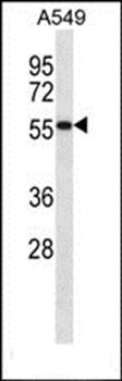SEMG1 antibody