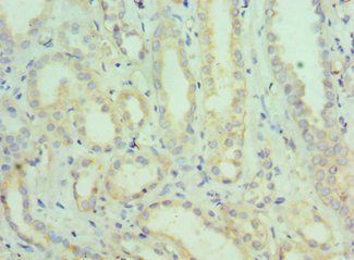 SEMG1 Antibody