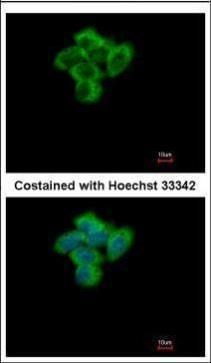 SENP2 antibody [N1], N-term