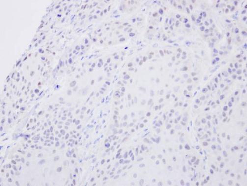 SENP2 Rabbit Polyclonal Antibody