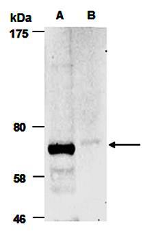 SENP2 (M) Antibody, Rabbit Polyclonal