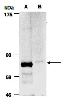 SENP2 antibody