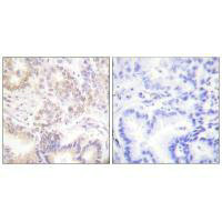 SENP5 antibody