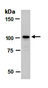 SENP5 antibody