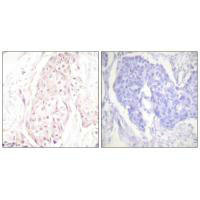 SENP8 Antibody