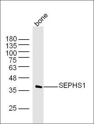 SEPHS1 antibody