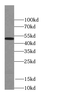 SEPT11 antibody