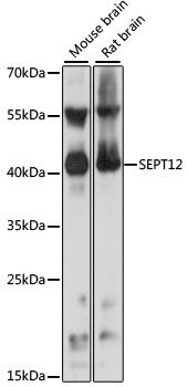 SEPT12 antibody