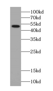 SEPT14 antibody