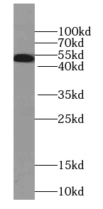 SEPT8 antibody
