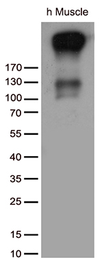 SERCA2 (ATP2A2) antibody