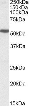 HTR3B antibody