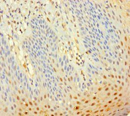 SERPINB3 Antibody
