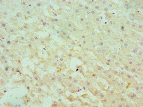 SERPINA10 Antibody