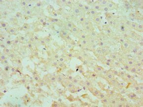 SERPINA10 antibody