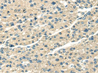 SERPINA12 Antibody