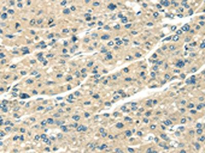 SERPINA12 antibody