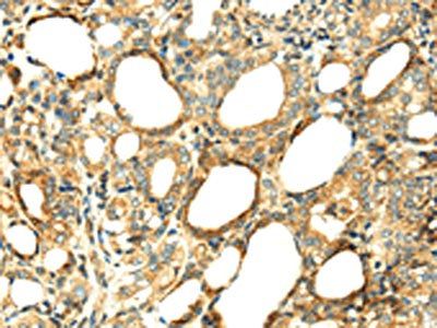 SERPINA12 antibody