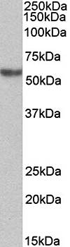 Goat anti-alpha-1-antitrypsin Antibody