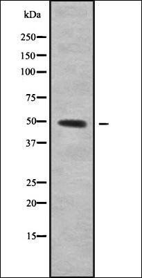 SERPINA2 antibody